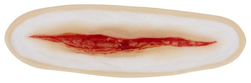 [3D-SB-W1] Wound 1 Silicone