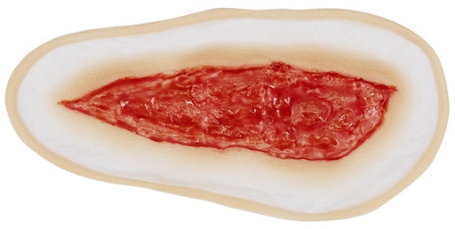 [3D-SB-W4] Wound 4 Silicone