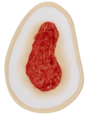 [3D-SB-W5] Wound 5 Silicone