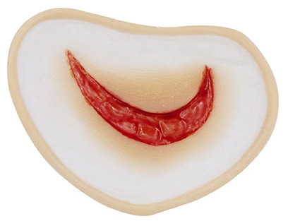 [3D-SB-W9] Wound 9 Silicone