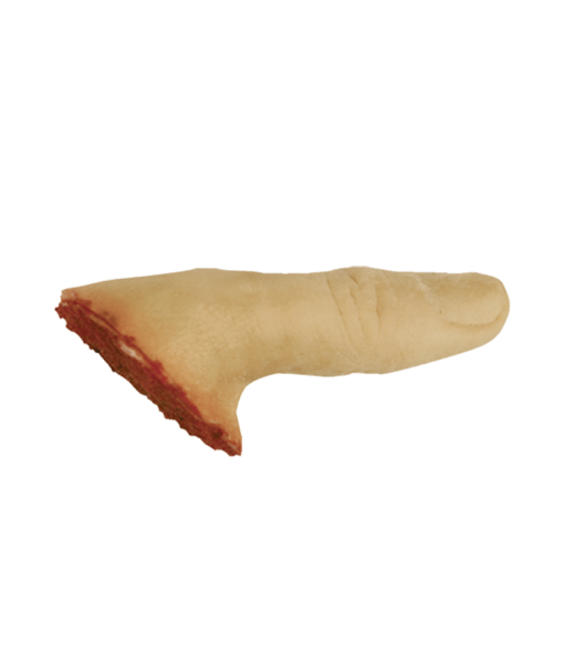 Severed Thumb, right