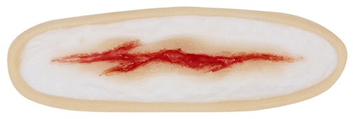 Wound 2 Silicone