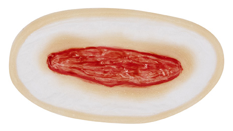 Wound 7 Silicone