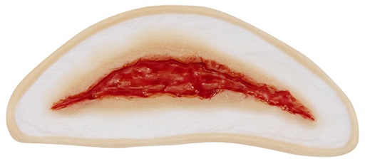 [3D-SB-ST2] Slit Throat 2 Silicone