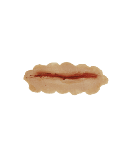 [3D-P-S2] Small Scar  6cm  PU Foam